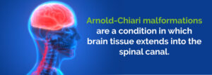Η ιατρική χρήση της Κάνναβης και η Δυσπλασία Arnold-Chiari